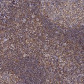 Anti-VAV1 antibody produced in rabbit Prestige Antibodies&#174; Powered by Atlas Antibodies, affinity isolated antibody, buffered aqueous glycerol solution