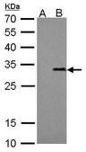 Monoclonal Anti-Strep Tag antibody produced in mouse clone GT661, affinity isolated antibody