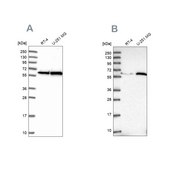 Anti-KPNA4 antibody produced in rabbit Prestige Antibodies&#174; Powered by Atlas Antibodies, affinity isolated antibody, buffered aqueous glycerol solution