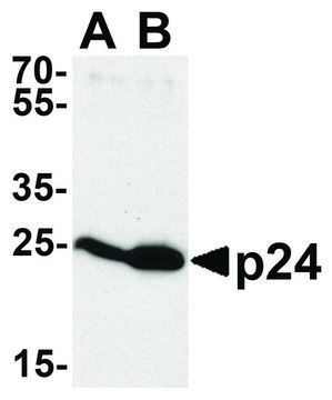 Anti-HIV-1 P24 antibody produced in rabbit affinity isolated antibody