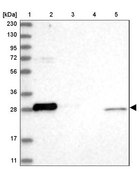 Anti-BCL2L1 antibody produced in rabbit Prestige Antibodies&#174; Powered by Atlas Antibodies, affinity isolated antibody, buffered aqueous glycerol solution