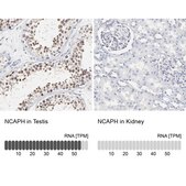 Anti-NCAPH antibody produced in rabbit Prestige Antibodies&#174; Powered by Atlas Antibodies, affinity isolated antibody, buffered aqueous glycerol solution