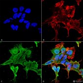 Monoclonal Anti-Versican - Hrp antibody produced in mouse clone S351-23, purified immunoglobulin