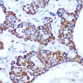 Anti- CASP1 antibody produced in rabbit