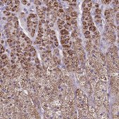 Anti-CYP11B2 antibody produced in rabbit Prestige Antibodies&#174; Powered by Atlas Antibodies, affinity isolated antibody, buffered aqueous glycerol solution