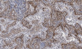 Anti-Integrin &#945;V&#946;5 Antibody, clone EM09902 , ZooMAb&#174; Rabbit Monoclonal recombinant, expressed in HEK 293 cells
