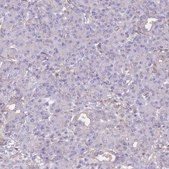 Anti-ADH1A antibody produced in rabbit Prestige Antibodies&#174; Powered by Atlas Antibodies, affinity isolated antibody, buffered aqueous glycerol solution