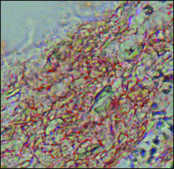 Anti-Fibroblast Growth Factor Receptor-2, Extracellular antibody produced in rabbit affinity isolated antibody, buffered aqueous solution