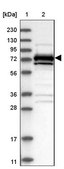 Anti-MAP3K2 antibody produced in rabbit Prestige Antibodies&#174; Powered by Atlas Antibodies, affinity isolated antibody, buffered aqueous glycerol solution