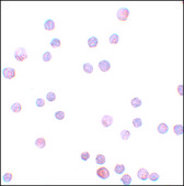 Anti-ZEB1 antibody produced in rabbit affinity isolated antibody, buffered aqueous solution