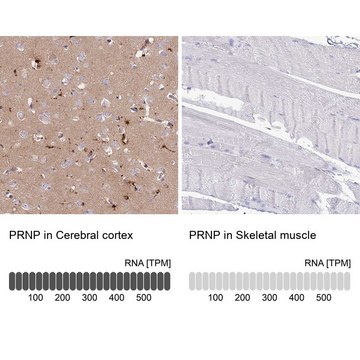 Anti-PRNP antibody produced in rabbit Prestige Antibodies® Powered by Atlas Antibodies, affinity isolated antibody, buffered aqueous glycerol solution