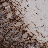 Monoclonal Anti-MBP antibody produced in mouse Prestige Antibodies&#174; Powered by Atlas Antibodies, clone CL2819, purified immunoglobulin, buffered aqueous glycerol solution