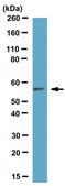 Anti-Calcineurin A&#946; Antibody from rabbit, purified by affinity chromatography