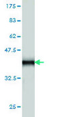 Monoclonal Anti-S100A7 antibody produced in mouse clone 1C1, purified immunoglobulin, buffered aqueous solution