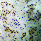 Anti-phospho-TIE2 (pTyr1108) antibody produced in rabbit affinity isolated antibody