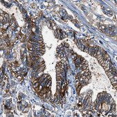 Anti-CLDN18 antibody produced in rabbit Prestige Antibodies&#174; Powered by Atlas Antibodies, affinity isolated antibody, buffered aqueous glycerol solution