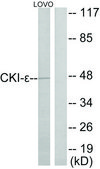 Anti-CKI-&#949; antibody produced in rabbit affinity isolated antibody