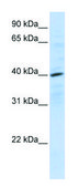 Anti-CXCR4 (N-terminal) antibody produced in rabbit affinity isolated antibody
