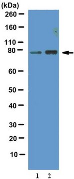 Anti-phospho-FOXO1 Antibody (Thr24) from rabbit, purified by affinity chromatography