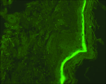 Monoclonal Anti-Involucrin antibody produced in mouse clone SY5, ascites fluid
