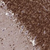 Anti-FTO antibody produced in rabbit Prestige Antibodies&#174; Powered by Atlas Antibodies, affinity isolated antibody