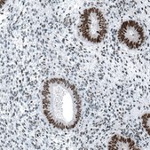 Monoclonal Anti-CHEK2 antibody produced in mouse Prestige Antibodies&#174; Powered by Atlas Antibodies, clone CL9440, purified immunoglobulin, buffered aqueous glycerol solution