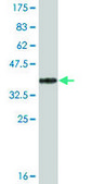 Monoclonal Anti-ACACB antibody produced in mouse clone 1C11, ascites fluid