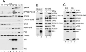 Anti-Chk2 Antibody, clone 7 clone 7, Upstate&#174;, from mouse