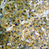 Anti-phospho-IkappaB-&#945; (pSer32/36) antibody produced in rabbit affinity isolated antibody