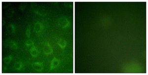 Anti-PDGFR &#946; antibody produced in rabbit affinity isolated antibody