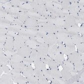 Anti-ABCB11 antibody produced in rabbit Prestige Antibodies&#174; Powered by Atlas Antibodies, affinity isolated antibody, buffered aqueous glycerol solution