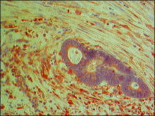 Anti-PKM2 (isoform M2) antibody produced in rabbit ~1.5&#160;mg/mL, affinity isolated antibody