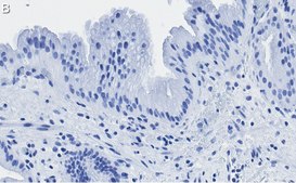 Anti-Nrf2 Antibody, clone 5B20 ZooMAb® Rabbit Monoclonal recombinant, expressed in HEK 293 cells