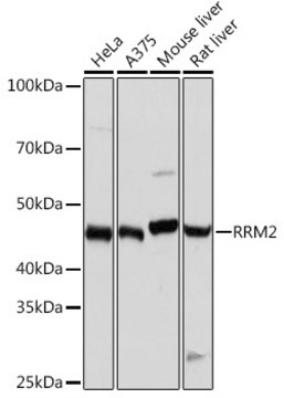 Anti-RRM2 Antibody, clone 10Y6E4, Rabbit Monoclonal