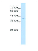 Anti-IRF1 (AB2) antibody produced in rabbit affinity isolated antibody