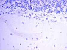 Anti-Neurofilament M (145 kDa) Antibody, CT serum, Chemicon&#174;