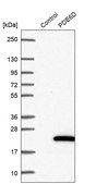 Anti-PDE6D antibody produced in rabbit Prestige Antibodies&#174; Powered by Atlas Antibodies, affinity isolated antibody, buffered aqueous glycerol solution