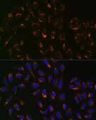 Anti-PBR/TSPO antibody produced in rabbit