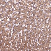 Anti-HYAL1 antibody produced in rabbit Prestige Antibodies&#174; Powered by Atlas Antibodies, affinity isolated antibody, buffered aqueous glycerol solution