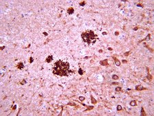 Anti-Amyloid &#946; Antibody, clone W0-2 clone WO2, from mouse