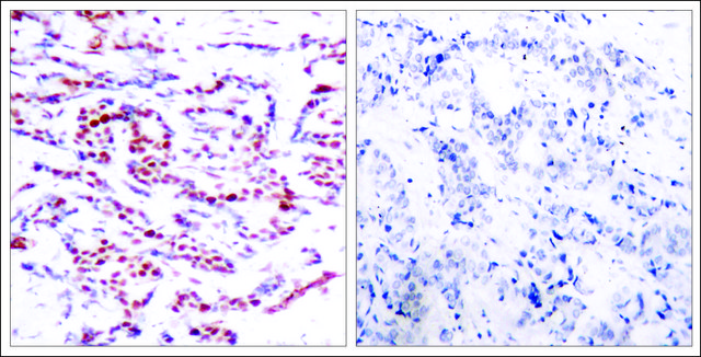 Anti-phospho-ATF2 (pThr71 or pThr53) antibody produced in rabbit affinity isolated antibody
