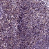 Anti-JAK3 antibody produced in rabbit Prestige Antibodies&#174; Powered by Atlas Antibodies, affinity isolated antibody, buffered aqueous glycerol solution