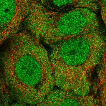 Anti-ALDH1A3 antibody produced in rabbit Prestige Antibodies&#174; Powered by Atlas Antibodies, affinity isolated antibody