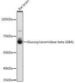Anti-Glucosylceramidase beta (GBA) antibody produced in rabbit