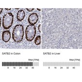 Anti-SATB2 antibody produced in rabbit Prestige Antibodies&#174; Powered by Atlas Antibodies, affinity isolated antibody, buffered aqueous glycerol solution