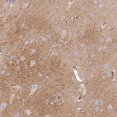Anti-SLC6A11 antibody produced in rabbit Prestige Antibodies&#174; Powered by Atlas Antibodies, affinity isolated antibody, buffered aqueous glycerol solution