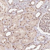 Anti-CAND1 antibody produced in rabbit Prestige Antibodies&#174; Powered by Atlas Antibodies, affinity isolated antibody, buffered aqueous glycerol solution