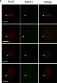 Anti-BRCA1 (Ab-1) Mouse mAb (MS110) liquid, clone MS110, Calbiochem&#174;