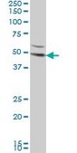 Monoclonal Anti-DKK1 antibody produced in mouse clone 2B12, purified immunoglobulin, buffered aqueous solution