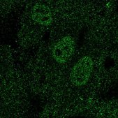 Anti-TAL1 antibody produced in rabbit Prestige Antibodies&#174; Powered by Atlas Antibodies, affinity isolated antibody